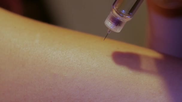 Młoda Kobieta Wykonuje Wstrzyknięcie Insuliny Ramię Zapobiega Cukrzycy Zbliża Wstrzykiwacz — Wideo stockowe