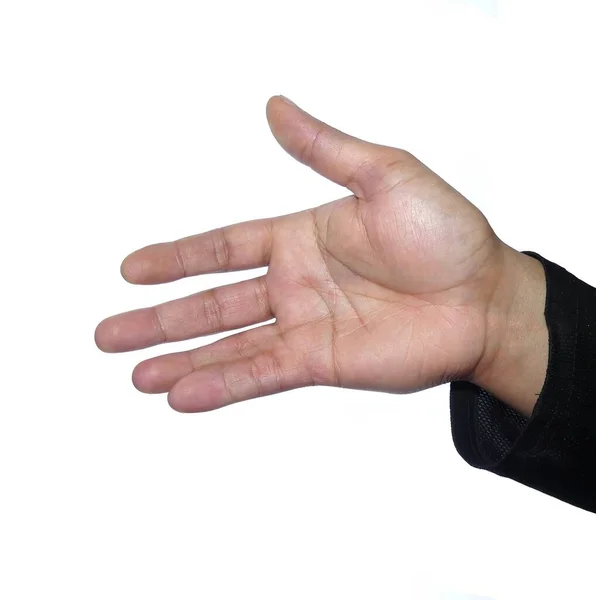 模糊的 一只被白色背景隔离的张开的手 表现出一种先天畸形 被称为联合畸形 其中两个手指被皮肤连接在一起 — 图库照片
