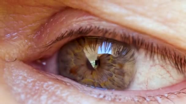 Olho Vermelho Esclera Irritada Olho Seco Piscar Íris Muito Verde — Vídeo de Stock