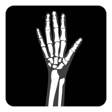 X-ray el ve parmaklar. Vektör illüstrasyonu