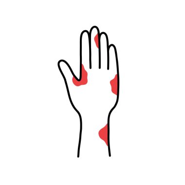 allergic reaction doodle icon, vector illustration