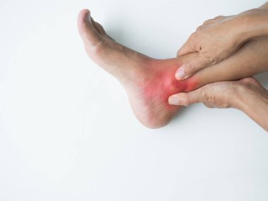Ağrılı ayak bileği ağrılı kadın, burkulmuş ayak topuğu yaralı insanlar kronik bacak yaralanması eklem yaralanması iskelet kız kazası spor egzersizi masaj, osteartrit tedavisi