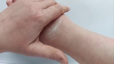 El Bakımı rutini. Soğuk Alerji ya da Sert Koşullar 'ın yol açtığı Kuraklığı, Kırılmayı ve Kırılmayı Alçaltmaya Özel Krem Uygulama