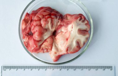 Dilimlenmiş sığır beyninin beyaz laboratuvar yüzeyinde şeffaf bir kabın içinde görünür iç yapıları ve cetvelle detaylı görüntüsü. Bilimsel steril ortamda anatomik tıbbi örnek gösterildi.