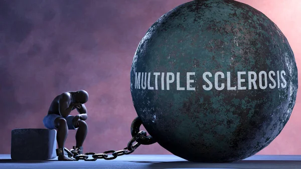 Multiple sclerosis - a metaphor showing human struggle with Multiple sclerosis. Resigned and exhausted person chained to Multiple sclerosis. Depressed by a continuous struggle