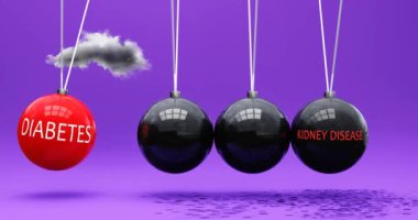 Diyabet böbrek hastalığına yol açar. Newton beşiğinde diyabetin böbrek hastalığını harekete geçirdiği bir metafor. Tehlikeli bir döngü. Diyabet ve böbrek hastalığı arasındaki sebep-sonuç ilişkisi. Döngüye alınabilir