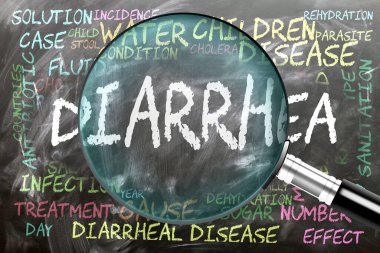 İshal inceleniyor, yakından inceleniyor. En önemli konular ve ishalle yakından ilgili fikirler bir büyüteç tarafından incelenen bir karatahtaya yazılmış..