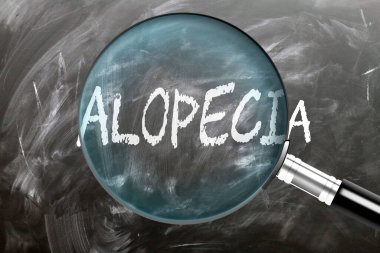 Alopecia, öğren, çalış ve incele. Alopecia 'ya daha yakından bakıyorum. Tahtaya 