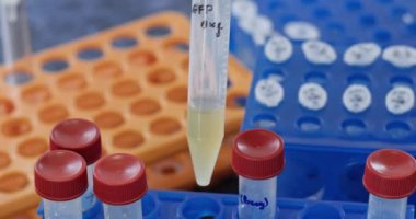 Laboratuvar asistanı sarı sıvı durumunu yakından kontrol etmek için test tüpleri alır. Tıbbi işçiler, biyolojik materyal örneklerini inceliyor.