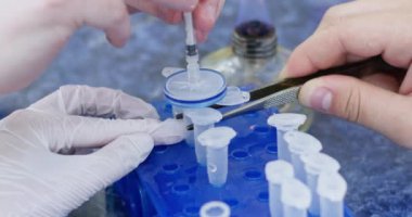 Teknisyenler virüs araştırmaları sırasında küçük bir test tüpünde numuneyi kontrol etmek için ayırıcı eklediler. Laboratuar çalışanları klinikte bulaşıcı hastalıkları inceliyor