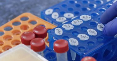 Laboratuvarcı sıvı reaksiyonunu kontrol ediyor. Tıbbi merkezden küçük test tüpleri alıyor. Laboratuvarda insan proteinleri araştırılıyor.