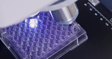 Laboratuvarda lazer mikroskobuyla çalışırken dökülme paleti. Laboratuvar optik aygıtıyla enfekte olmuş materyal analiz ediliyor.