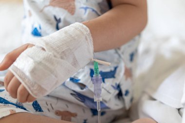 Hastanede serum fizyolojik solüsyonuyla çocuk elini kapat.