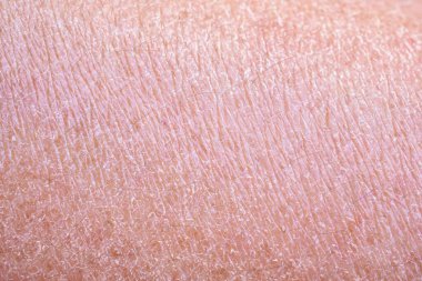 dry and dehydrated human skin texture background clipart