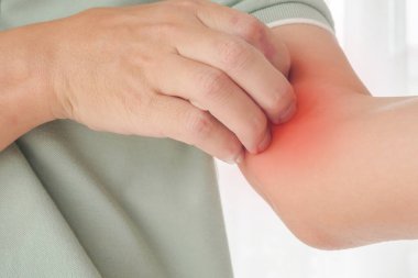 Genç Asyalı adam kaşınıyor ve kolunda kaşındırıyor kuru cilt egzama dermatiti yüzünden.