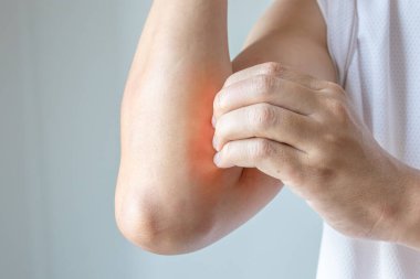 Genç Asyalı adam kaşınıyor ve kolunda kaşıntı var alerjik kaşıntı yüzünden kuru cilt egzama dermatit böceği ısırıkları.