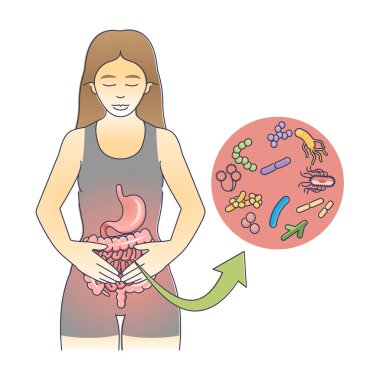 Mide iltihabı diyagramı olarak gastrointestinal iltihap. Bakteriyel mide ve bağırsak enfeksiyonu taşıyıcı illüstrasyonlu eğitim şeması. Tıbbi virüs ishale ya da kusmaya neden olmuş.