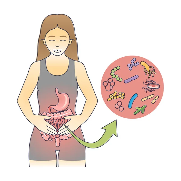 Gastroenteritis Als Magen Darm Entzündung Skizze Lehrplan Mit Bakterieller Magen — Stockvektor