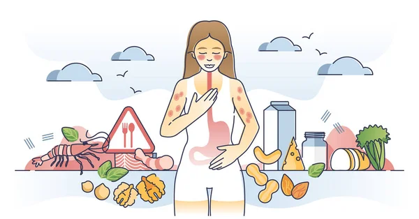 Réaction Allergique Des Ingrédients Alimentaires Des Produits Épicerie Décrit Concept — Image vectorielle