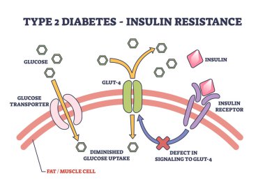 Tip 2 diyabet ve insülin direnci anatomik açıklama şeması. İnsülin reseptörü, GLUT kusuru ve azalmış kabartma vektör çizimi ile etiketli tıp bilimi gösterimi.