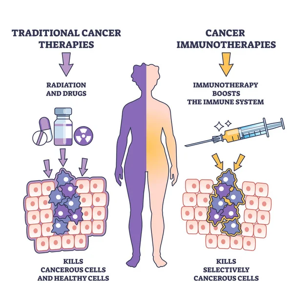 免疫系の概要図のための癌治療のための免疫療法方法 腫瘍疾患ベクトル図の医療治療としてラベル付けされた教育スキーム 癌細胞を選択的に殺す — ストックベクタ