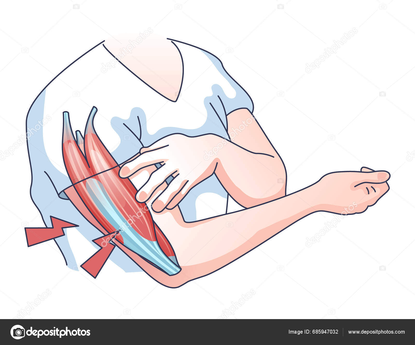 Muscle Weakness Weak Fatigue Muscular System Outline Concept Medical