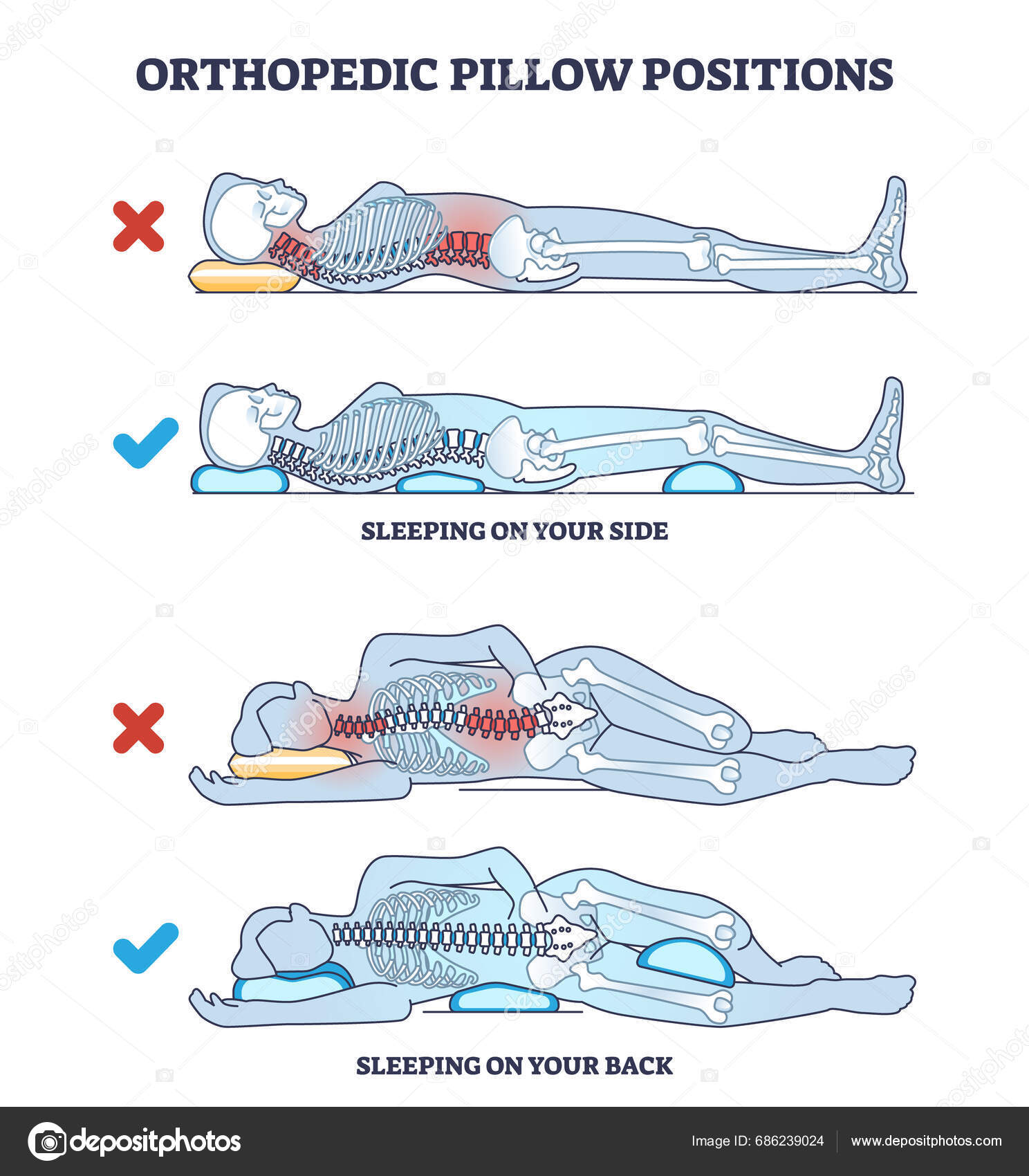 Orthopedic Pillow Positions Sleeping Side Back Outline Diagram Labeled