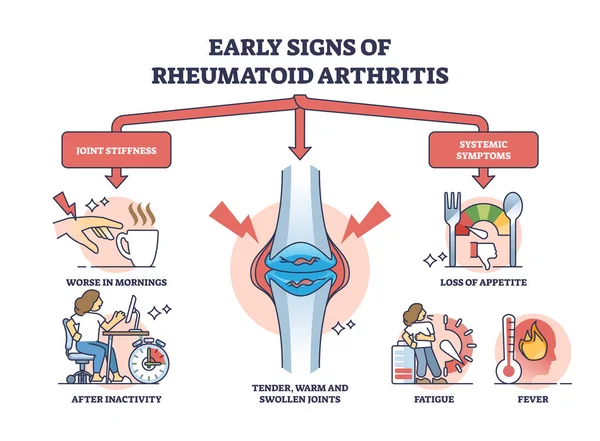 Časné Příznaky Revmatoidní Artritidy Diagram Bolesti Kloubů Označená Výchovná Ztuhlost — Stockový vektor