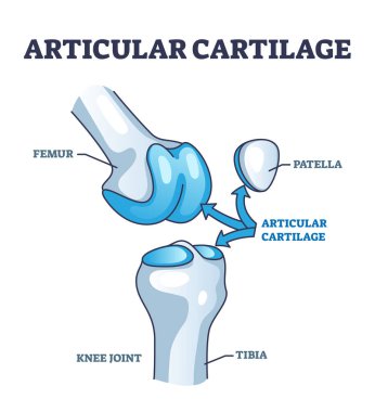 Articular cartilage structure and location in knee joint outline diagram. Labeled educational scheme with femur, tibia and patella parts vector illustration. Healthy leg skeleton movement explanation clipart