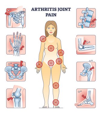 Arthritis joint pain with affected locations on human body outline diagram. Points of painful skeletal areas with anatomical chronic or acute illness vector illustration. Skeleton bone Inflammation. clipart