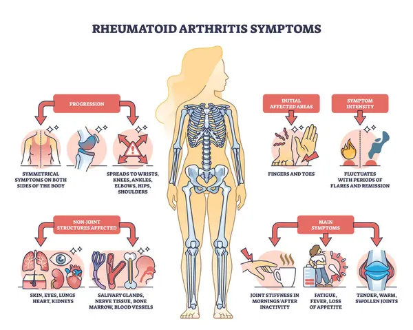 Rheumatoid Arthritis Symptoms Joint Inflammation Disease Outline Diagram Labeled Educational — Stock Vector
