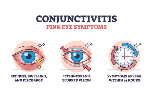 Bindehautentzündung Oder Rosa Augensymptome Mit Einfachen Erklärungsskizzen Beschriftetes Bildungsschema Mit — Stockvektor