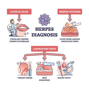 Herpes teşhisi ve HSV virüsü tıbbi teşhis yöntemleri ana hatları. Klinik muayene, görsel teftiş, uçuk kültürü ve laboratuvar testleri vektör ilülasyonu ile etiketlenmiş eğitim şeması.