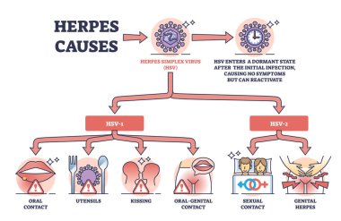 Herpes neden olur ve tıbbi cilt HSV virüs iletim şeması. Dermatolojik sorun aktivasyonu ile etiketlenmiş eğitim listesi vektör illüstrasyonuna neden olur. Oral öpüşme ve cinsel temas.