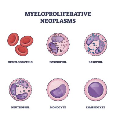 Kemik iliği kan hastalıkları şemayı belirlerken miyeloproliferatif neoplazmalar. Tıbbi eosinophil, basophil, nötrofil, monosit ve lenfosit listesindeki vektör çizimi ile etiketlenmiş eğitim şeması.