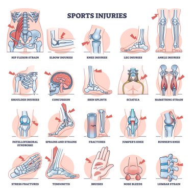 Spor yaraları ve en yaygın atlet travmaları koleksiyon seti. Sağlık sorunları ve eğitim kazaları ile etiketlenmiş sağlık listesi trenler, kırıklar, burkulmalar ve vektör illüstrasyonları