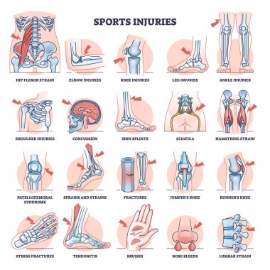 Sport injuries and most common athlete traumas outline collection set. Labeled medical list with health problems and training accidents with trains, fractures, sprains and splints vector illustration clipart