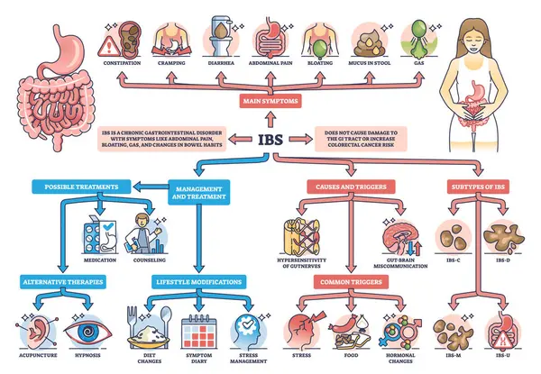 IBS ya da asabi çardak sendromu sebep olur ve durum semptomları ana hatları çizer. Sindirim sistemi kronik problem vektör illüstrasyonu ile etiketlenmiş eğitim şeması. Tıbbi gastrointestinal bozukluk.