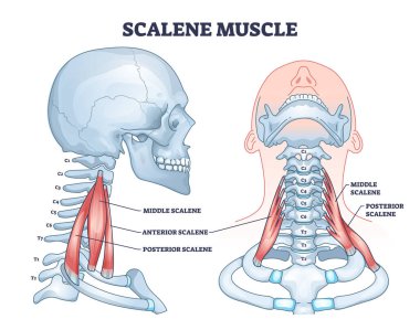 Scalene muscle structure with medical location on neck outline diagram. Labeled educational anatomical sprain scheme with middle, anterior and posterior parts of muscular system vector illustration. clipart