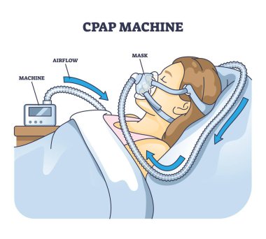 CPAP makine diyagramı hava akışını, maskeyi ve makine bağlantısını gösteriyor. Özet diyagramı.