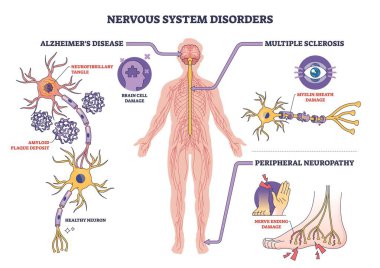 Sinir sistemi bozuklukları nöron, beyin ve sinirlerin etiketli diyagramlarıyla gösterilir ve hasarın anahtar bölgelerini vurgular. Özet diyagramı