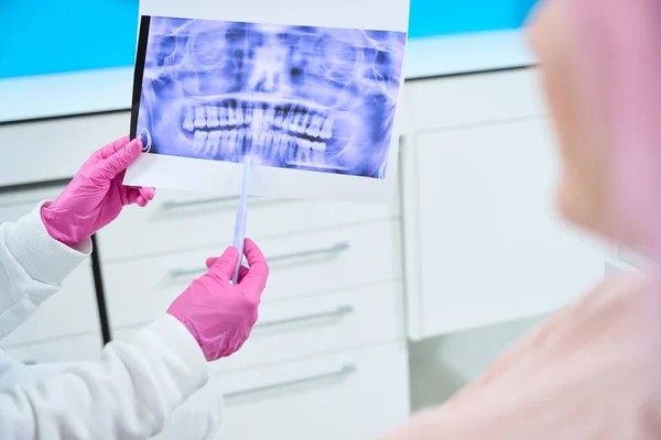 Doktor Drží Rentgen Zubního Kazu Svých Rukou Ortodontista Konzultuje Pacienta — Stock fotografie