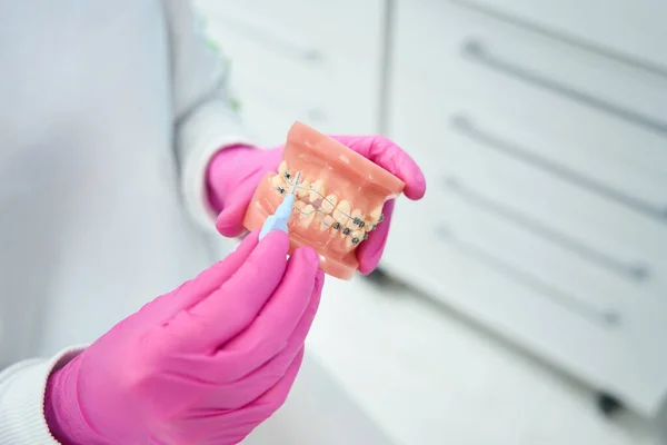 Ortodontista Drží Svých Rukou Model Zubního Kazu Rovnátky Speciálním Nástrojem — Stock fotografie