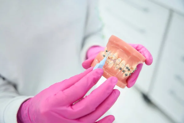 Médico Sostiene Sus Manos Dentición Modelo Con Aparatos Ortopédicos Una — Foto de Stock