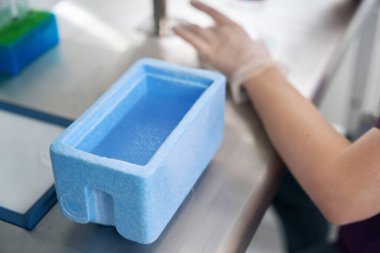 Laboratory employee works with a biomaterial for immersion in a cuvette with liquid nitrogen, this is the vitrification of embryos