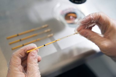 Laboratory assistant in protective gloves places the biomaterial into the straw for the embryo for the subsequent vitrification procedure