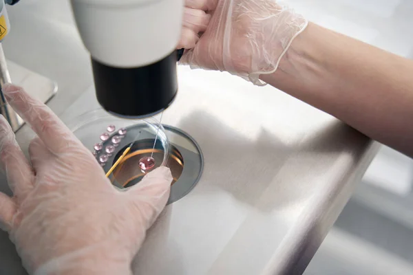 Embriólogo Científico Pone Los Embriones Una Paja Especial Para Vitrificación —  Fotos de Stock