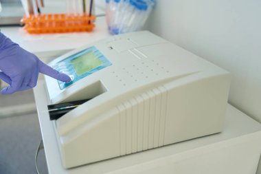 Laboratory assistant in the testing unit presses the button of the urine analyzer, he uses the test strips