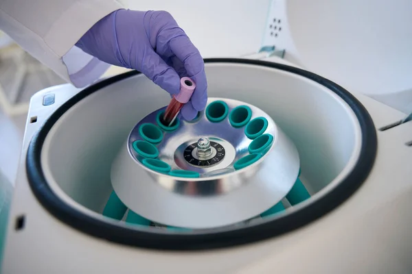 Laboratory assistant in a diagnostic laboratory puts a test tube with a blood sample into a hematological centrifuge