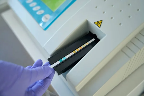 Laboratory Assistant Testing Unit Applies Test Strip Urine Analyzer Person — Stock Photo, Image